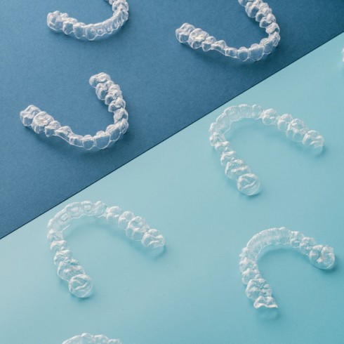 Guide to wearing aligners